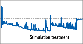 Pressure versus time graph showing effects of stimulation treatment.